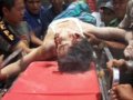 印尼地震死亡人数已经升至80人 医院人满为患